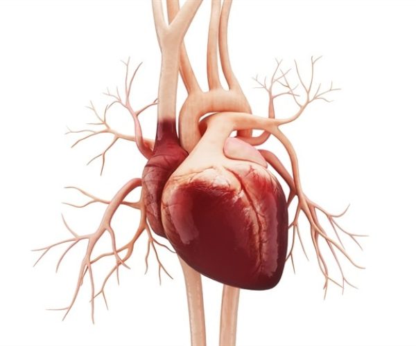 South Asian heart disease