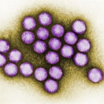 vaccine-induced immune thrombocytopenia