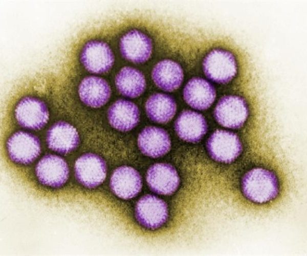 vaccine-induced immune thrombocytopenia