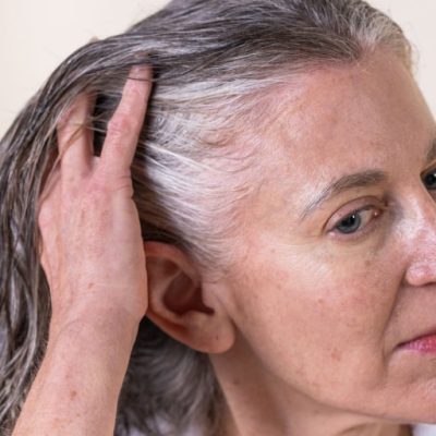 hair shedding vs hair loss