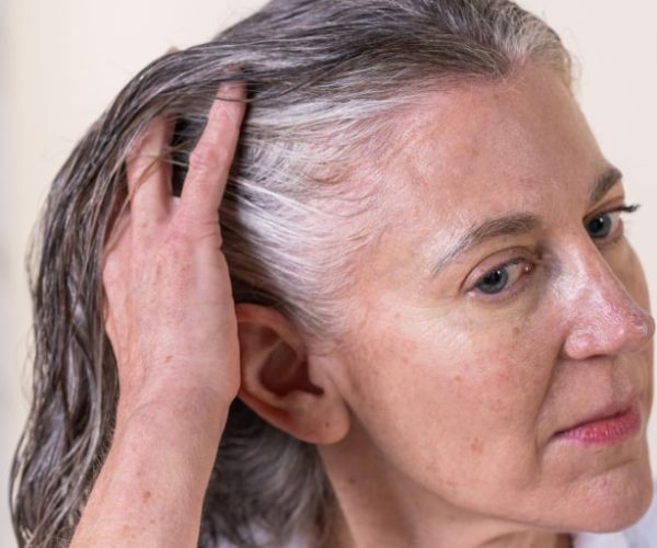 hair shedding vs hair loss