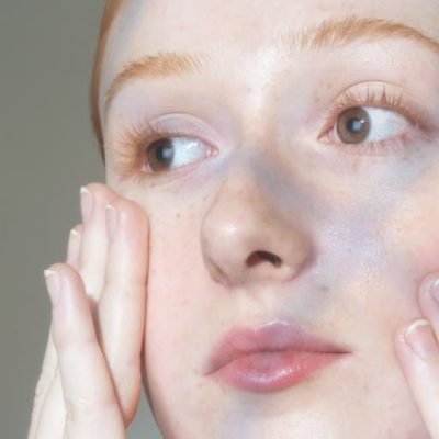 acne treatments for teens