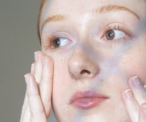 acne treatments for teens