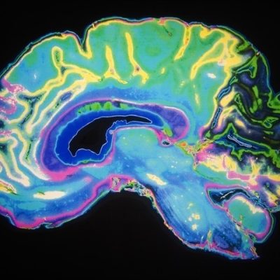 brain cells navigation