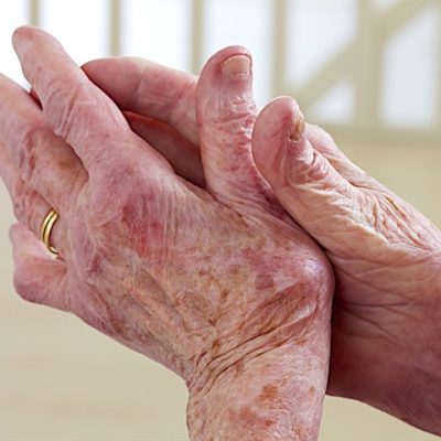 prebiotic fiber osteoarthritis