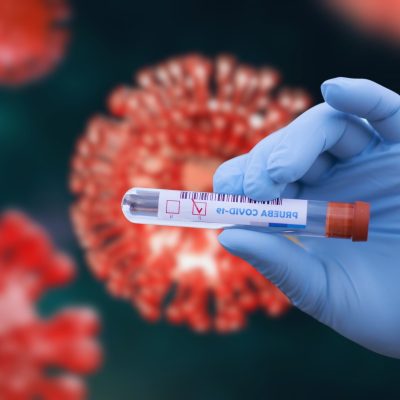 post-COVID vaccination syndrome