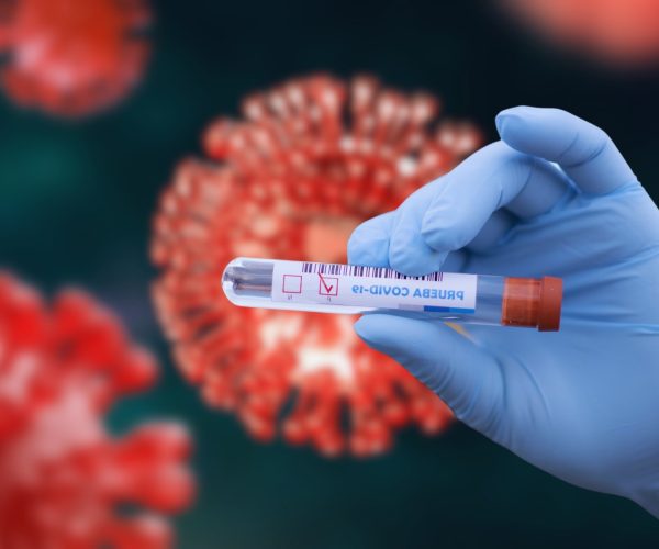 post-COVID vaccination syndrome