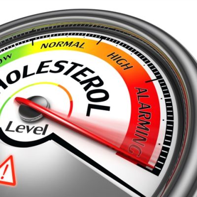cholesterol screening guidelines