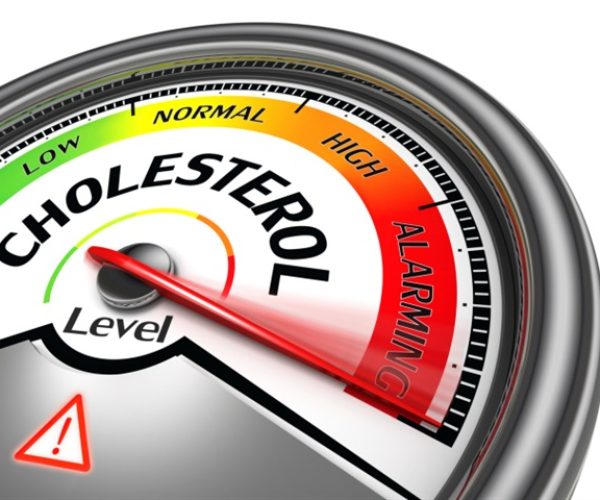 cholesterol screening guidelines
